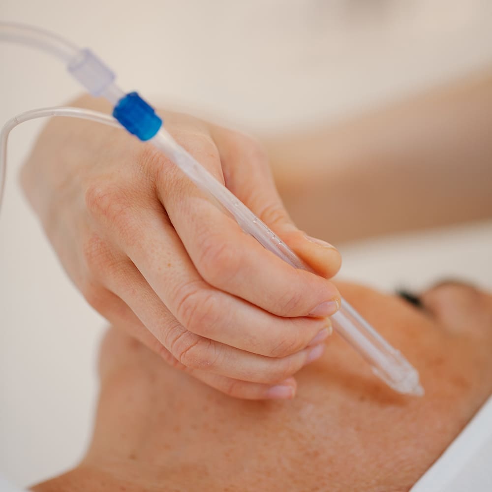 Wie funktioniert die JetPeel Technologie?