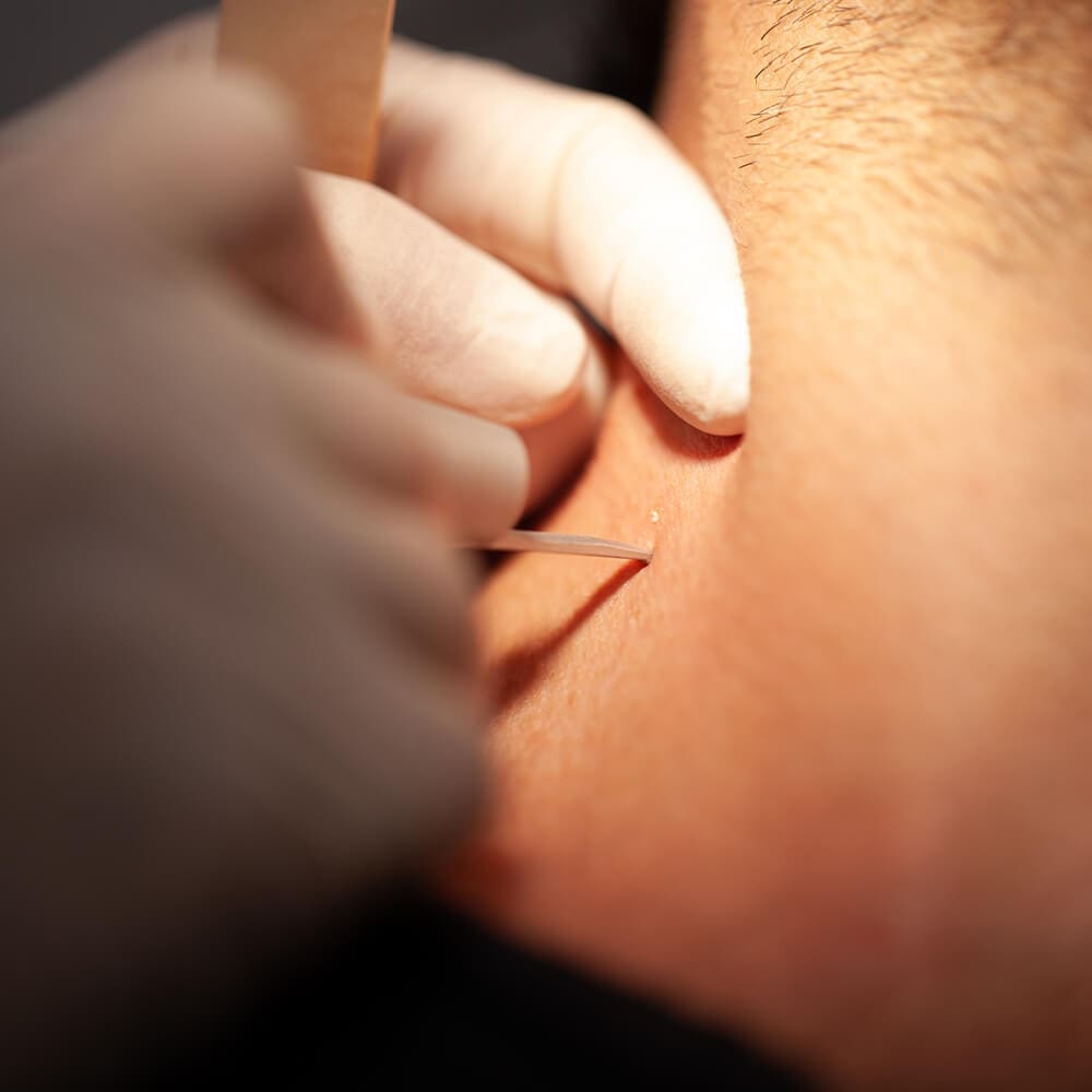 Ihre Haut ist einzigartig!