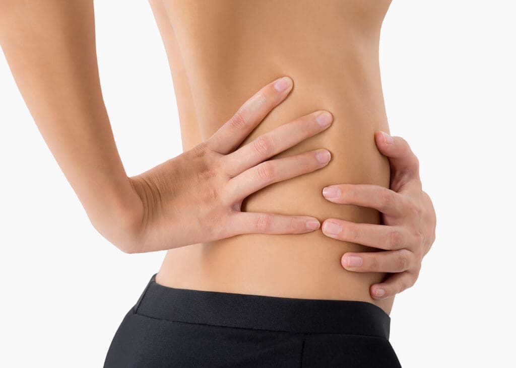 Was ist eine Rektusdiastase?