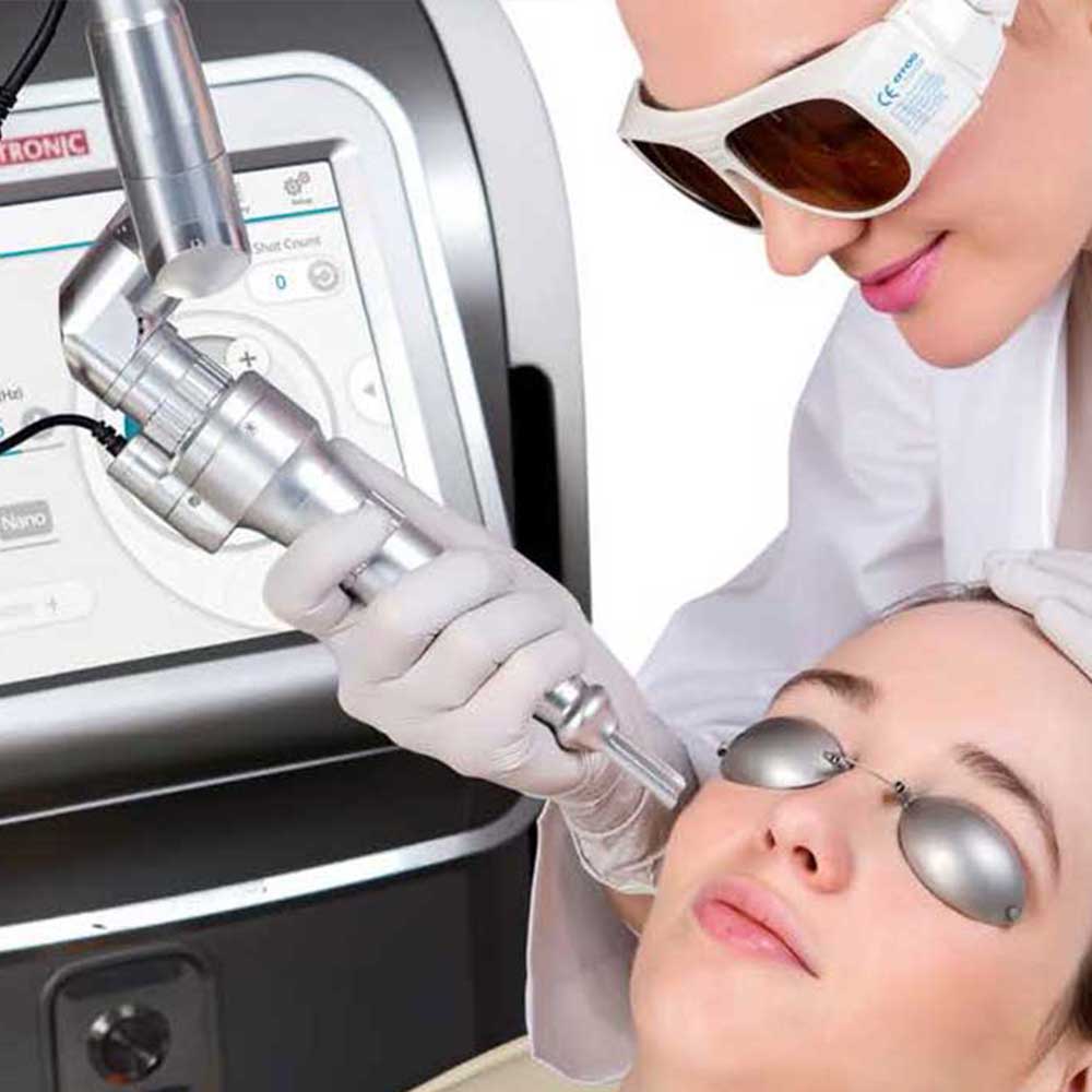 What is Carbon Peeling?